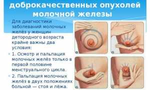 Образования в груди: возможные причины, виды, необходимая диагностика, методы лечения, советы маммологов