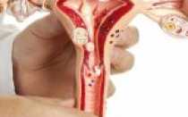 Причины и виды маточного кровотечения у женщин после 40–50 лет