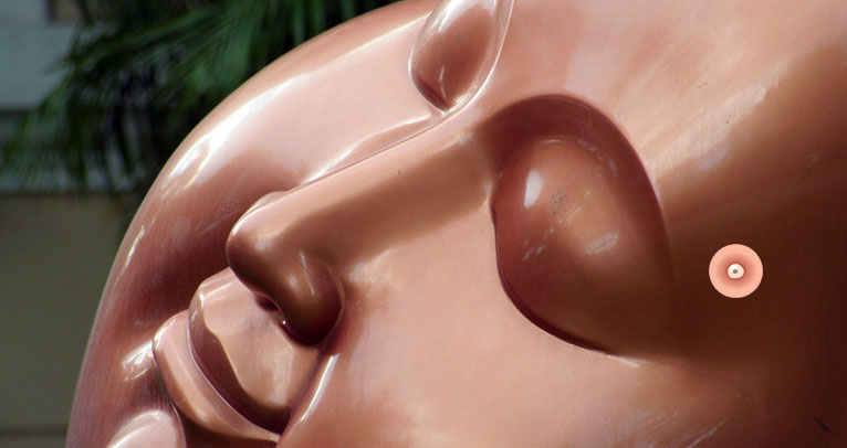 прыщ на виске 2