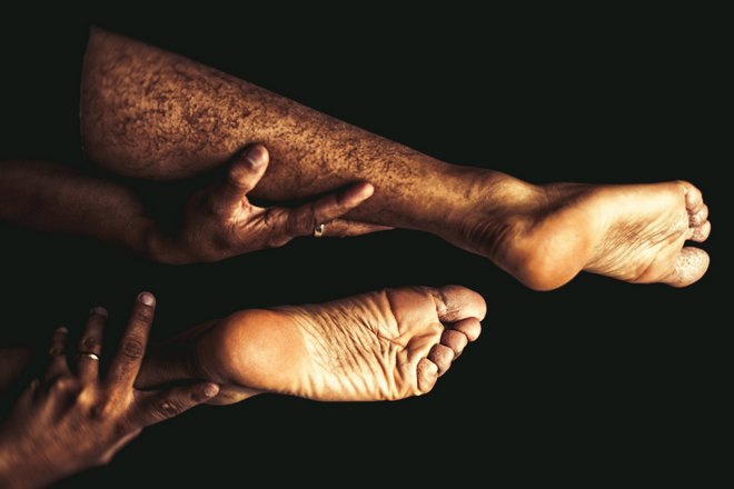 Зачесались обе ноги