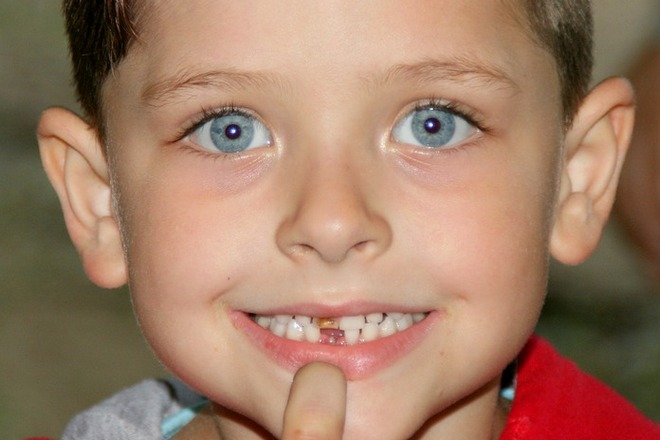 Сон о ребенке с выпавшим молочным зубом