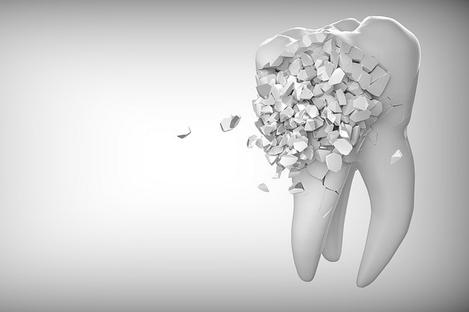 Сон о разрушенном зубе