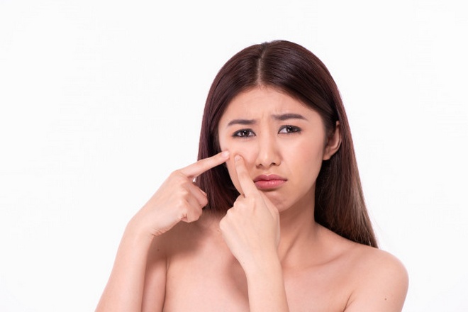 Девушка обеспокоена появлением прыща под глазом