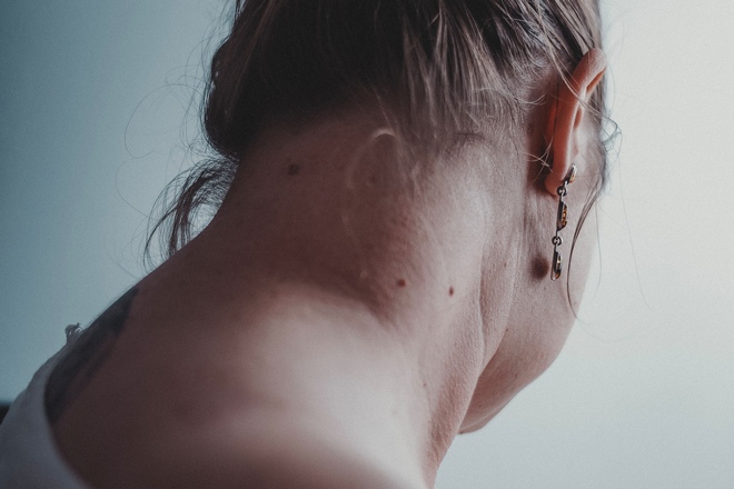 Женщина с несколькими родинками на шее