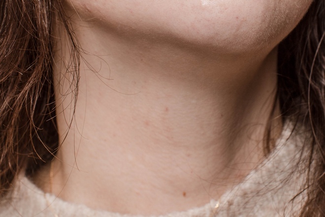 Несколько родинок у девушки недалеко от центра шеи