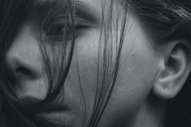 Родинки могут быть малозаметными