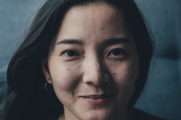 Родинки под обоими глазами