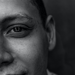 Родинки возле левого глаза