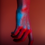 Родинки бывают разноцветными