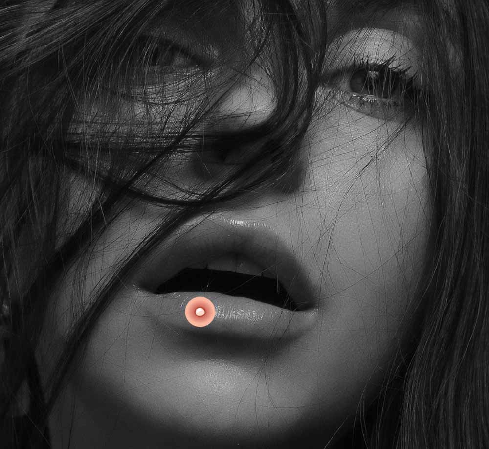 прыщ на губе 7