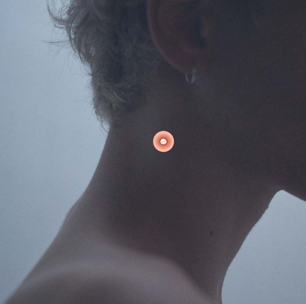 прыщ на шее 3