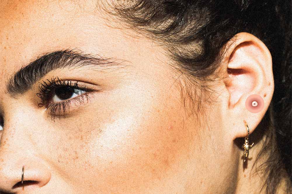 прыщ в ухе 6