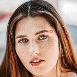 прыщ на виске 10