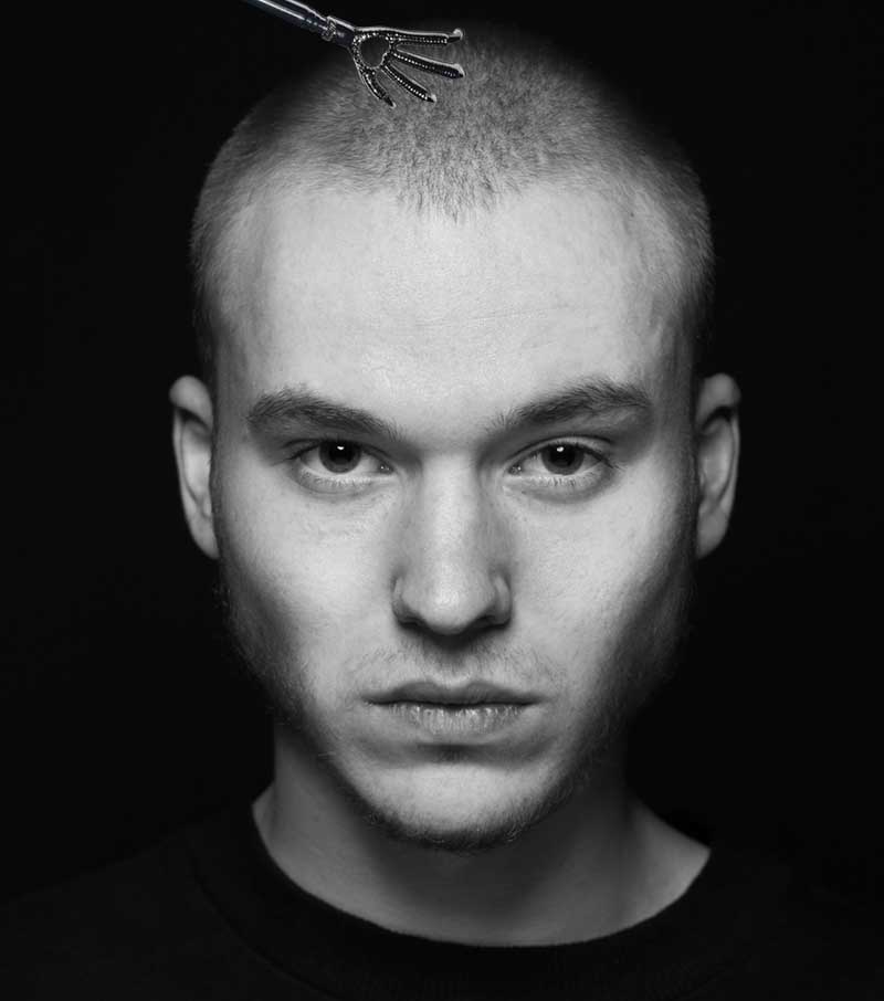 чешется макушка