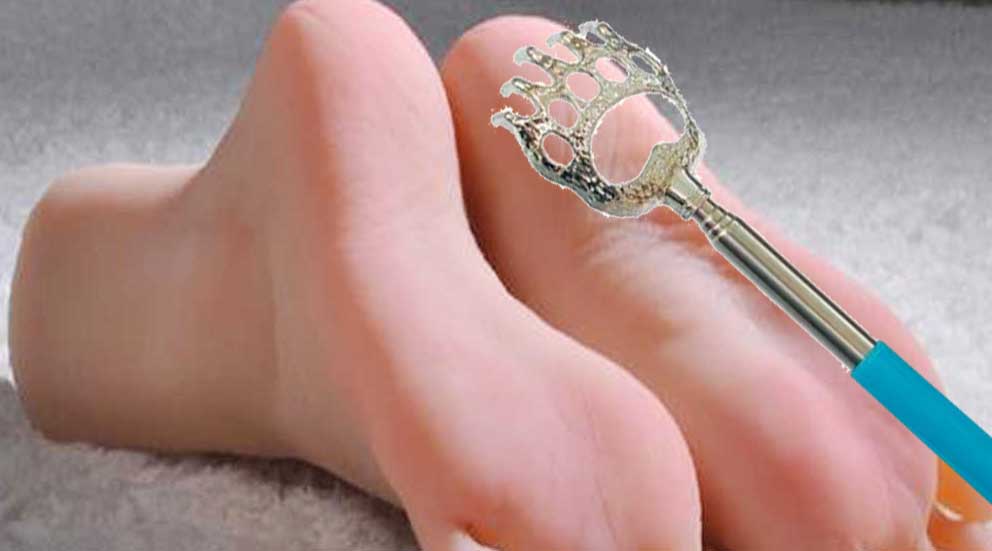 чешется пятка4