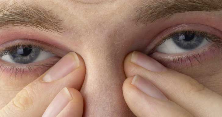 чешутся глаза3