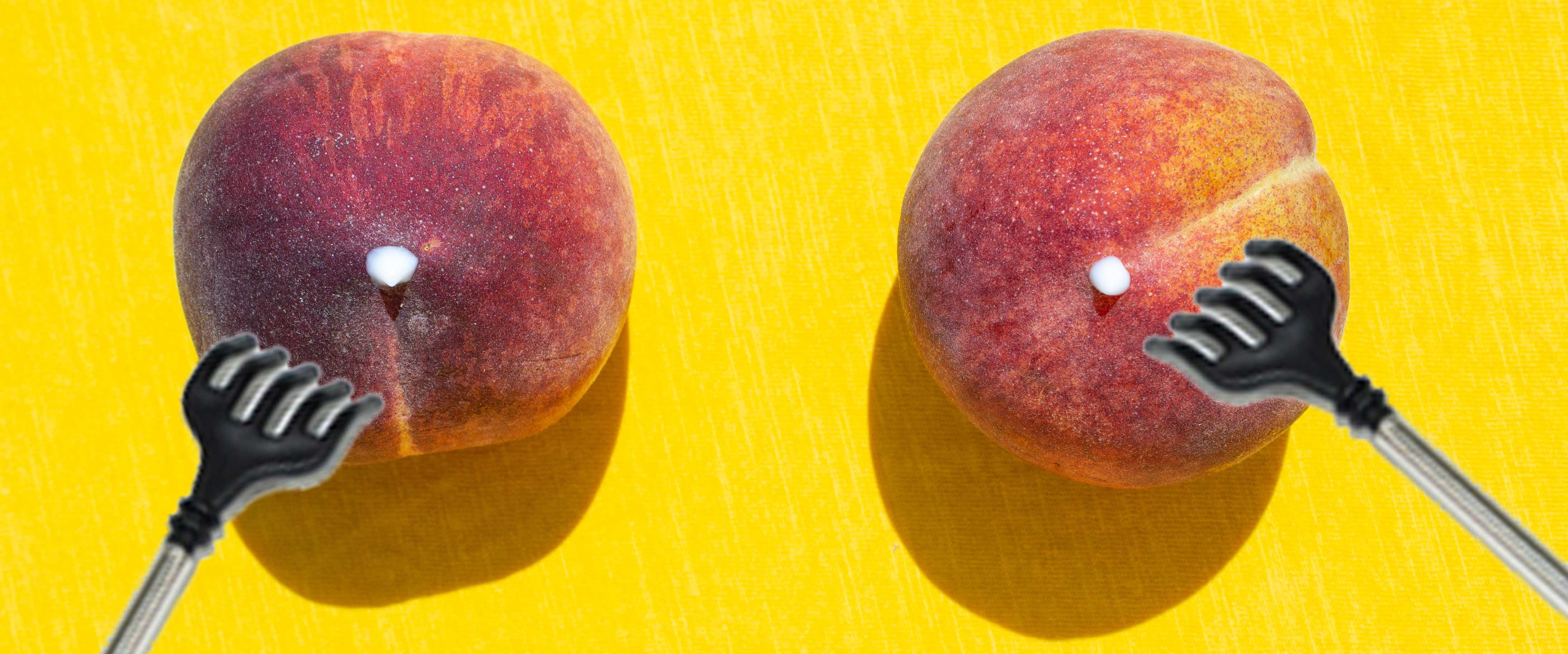 грудь чешется с двух сторон