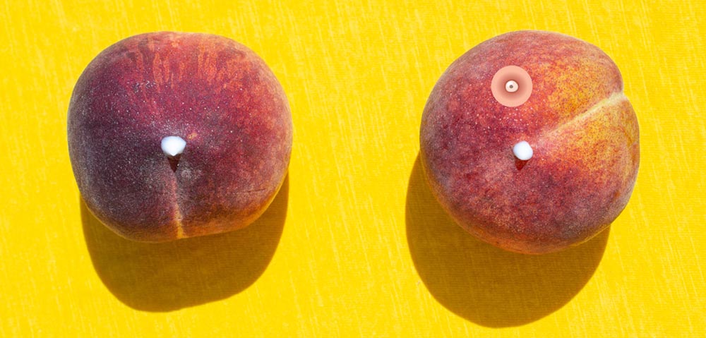 прыщ на груди 7