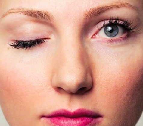 дергается бровь6