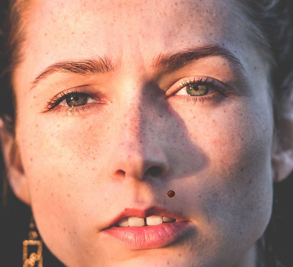 родинка над губой 7