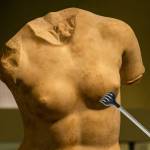 чешется грудь слева у женщины