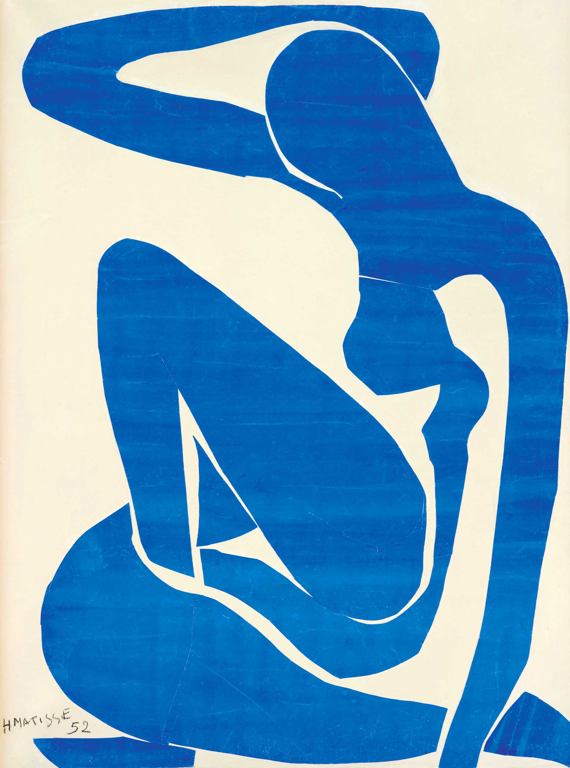 левая нога9