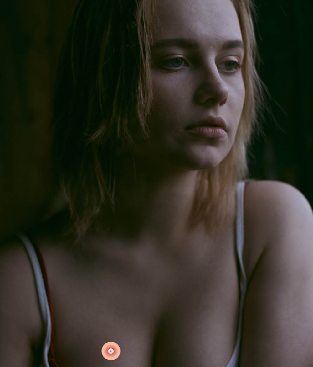 прыщ на груди 5