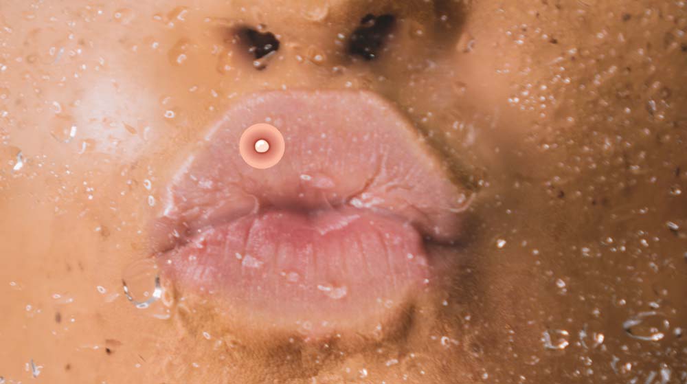 прыщ на губе 8