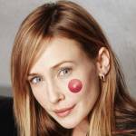 на левой щеке 3