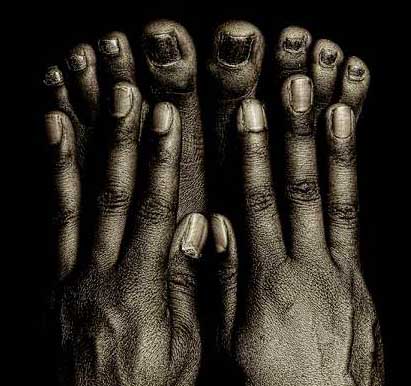 пальцы на ногах6