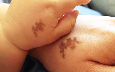 родинка хиромантия 2