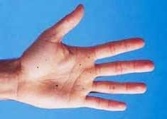 родинка хиромантия 5