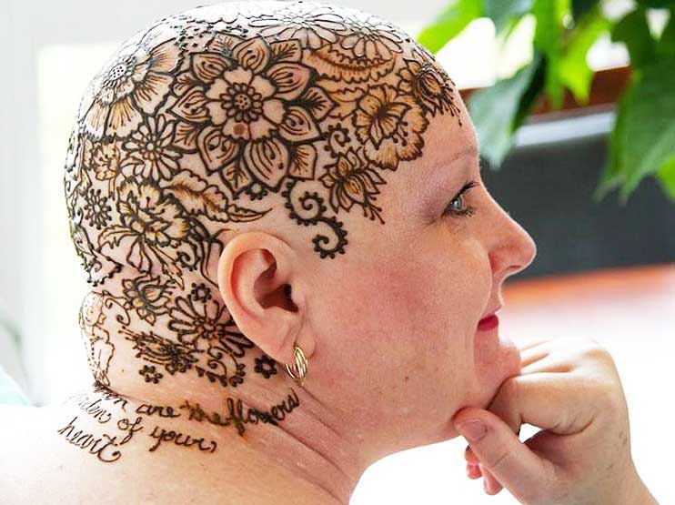 родинка на голове3