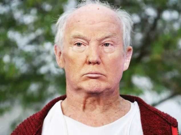 родинка на голове5