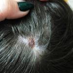 родинка на голове6