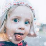 прыщ на языке 4