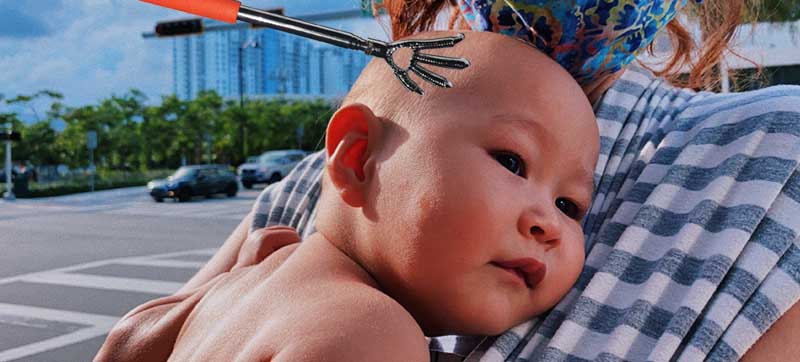 у ребенка чешется голова