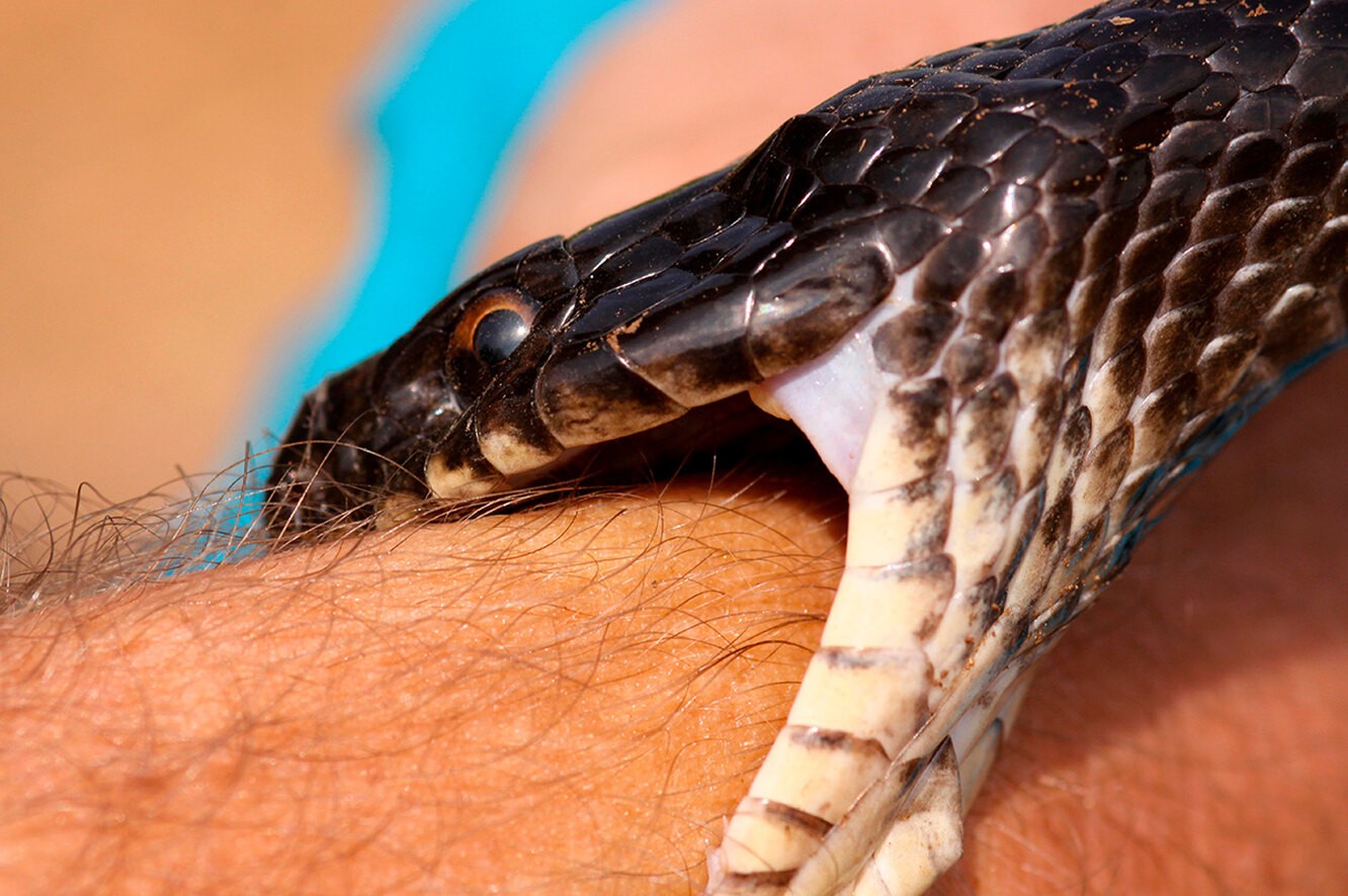 волосы на теле человека и укус змеи