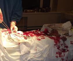 Кровь в операционной