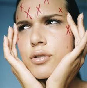 Заболевание кожи