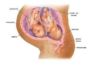 Беременность двойняшками