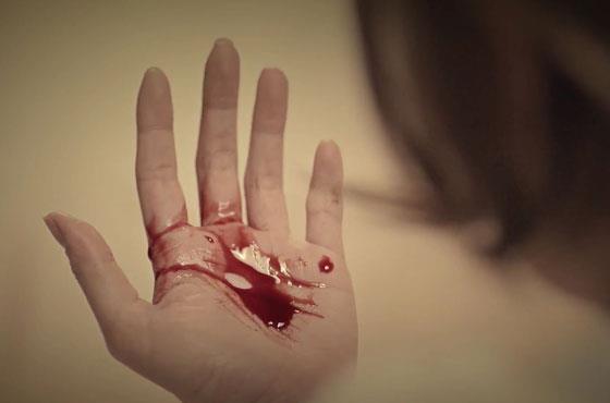 Кровь на ладони